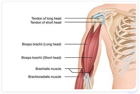 Distal Biceps Tendon Tears| Advanced Regenerative Medicine