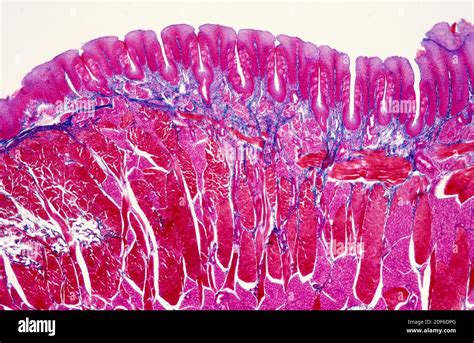 Muscle cells (cross section) hi-res stock photography and images - Alamy