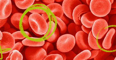 How to increase hemoglobin: Foods, home remedies, and more