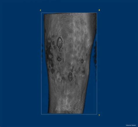 MRI Scan Showing Alternative M [IMAGE] | EurekAlert! Science News Releases