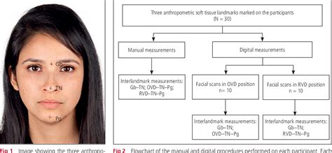 [PDF] Digital and analog vertical dimension measurements: A clinical ...