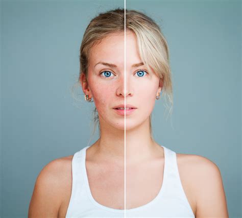 Sun Damage Prevention: How to Protect Your Skin and Eyes - Kellys ...