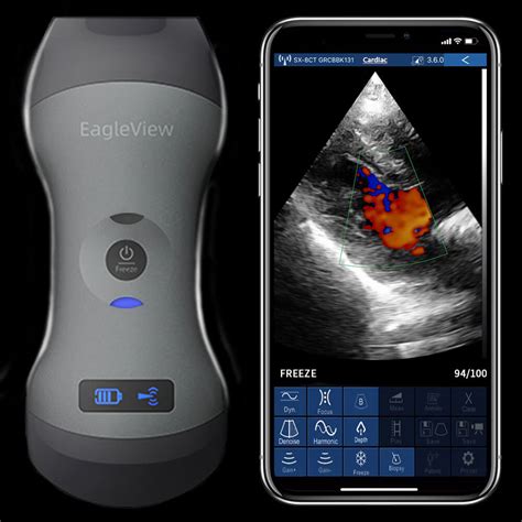 Portable Ultrasound | ubicaciondepersonas.cdmx.gob.mx