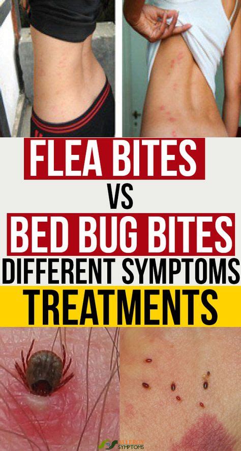 Flea Bites vs. Bed Bug Bites: Different Symptoms, Treatments | Bed bug ...