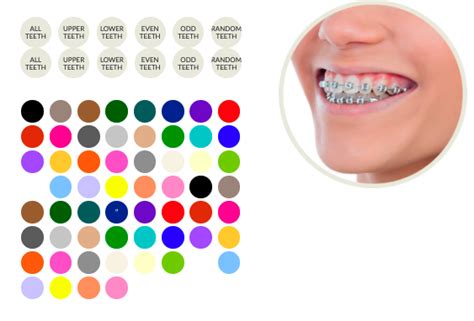 Smiles Hollywood McKinney Orthodontist | Cool Braces Colors