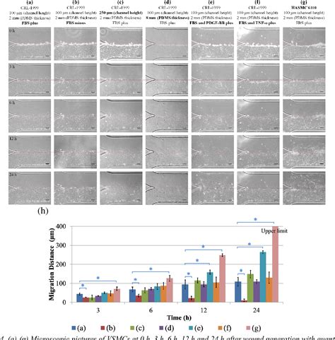 Figure 2 from A tubing-free microfluidic wound-healing assay ...