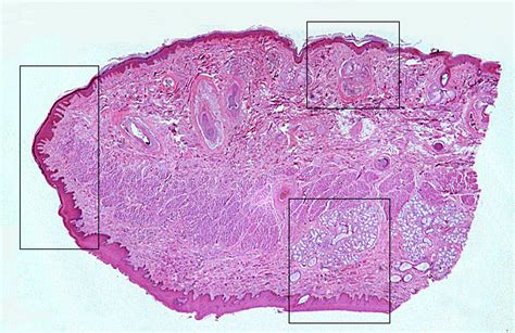 HLS [ Digestive System: Oral Cavity and Teeth, lip, oral mucosa] LOW MAG