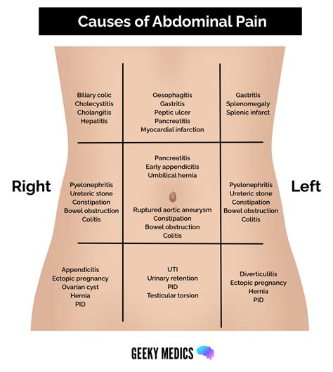 Abdominal Pain History Taking - OSCE Guide | Geeky Medics