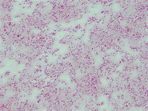 Pseudomonas aeruginosa Gram-stain - a photo on Flickriver