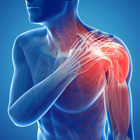 Shoulder and upper arm – GMphysio