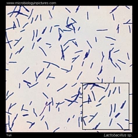 Lactobacillus