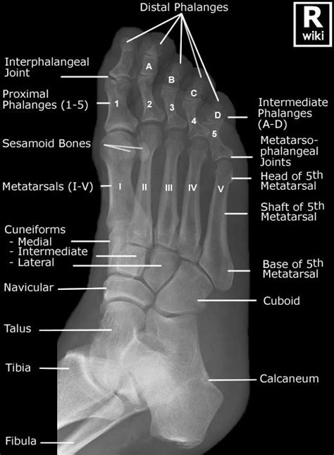 Anatomy For Radiology - Anatomical Charts & Posters