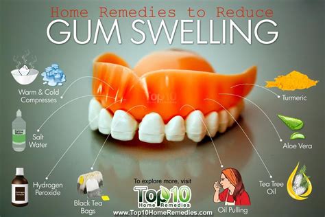 Home Remedies to Reduce Gum Swelling | Top 10 Home Remedies