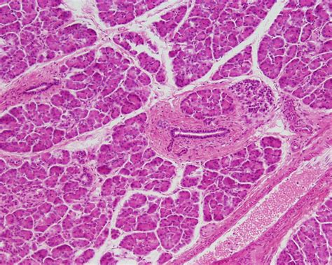 File:Pancreas histology 101.jpg - Embryology