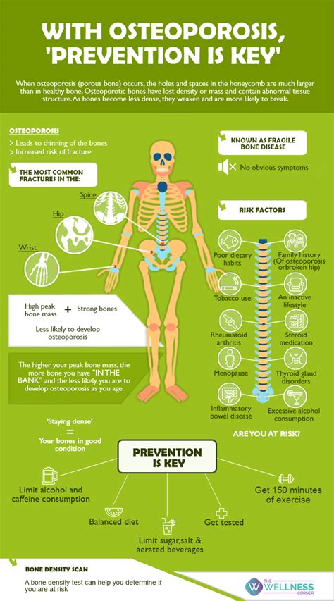 With osteoporosis, 'prevention is the key' - The Wellness Corner