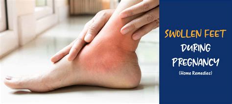 Home Remedies For Swollen Feet During Pregnancy | MedPlusMart