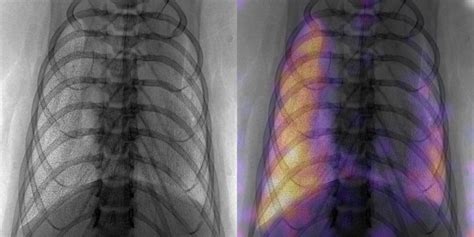 X-Ray Phase-Contrast (XPC) Imaging and Tomography – Computational ...