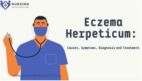 Eczema Herpeticum: Causes, Symptoms, Diagnosis and Treatment | Nursing ...