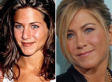 jennnn | Jennifer aniston nose, Jennifer aniston nose job, Jennifer ...