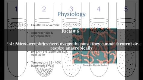 Facultative anaerobic organism Top # 10 Facts - YouTube