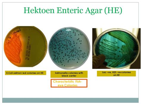 On Hektoen Enteric Agar Microbiology, Microbiology Lab,, 46% OFF