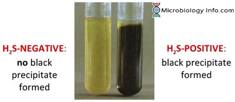 Hydrogen Sulfide Test - Principle, Procedure, Uses and Interpretation