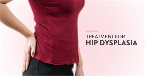 Hip dysplasia: What is it and how is it treated? | CK Birla Hospital