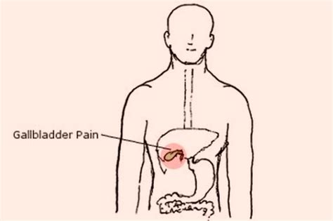 Gallbladder Pain – Location, Symptoms, Relief and Treatment | HubPages