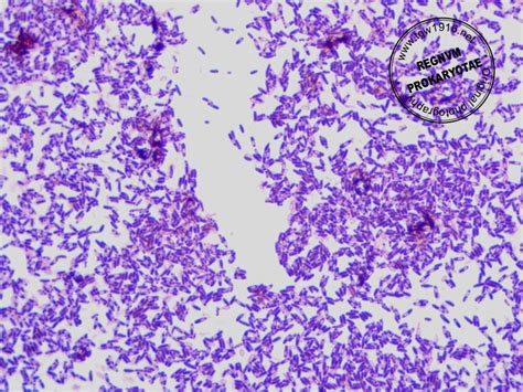 Bacillus Coagulans Gram Stain