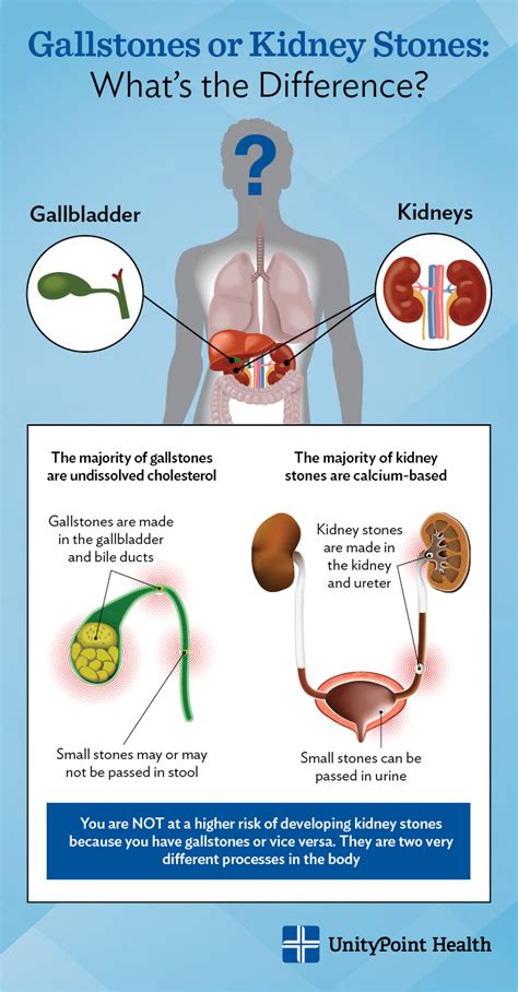 Gallbladder Pain Location Diagram - exatin.info