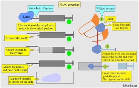 Fine Needle Aspiration Cytology (FNAC) - A Useful Test for Lesion Diagnosis