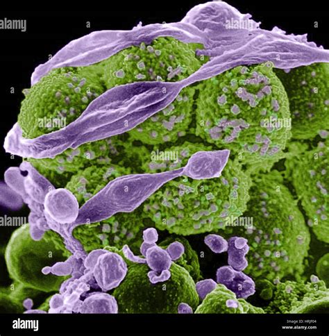 Staphylococcus Aureus Mrsa Bacteria