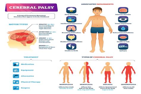 Cerebral Palsy | LegalFinders