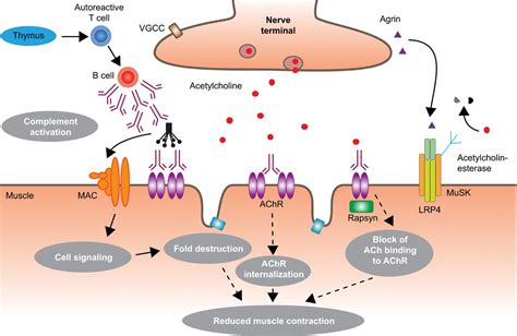 Neuromuscular Junction Myasthenia Gravis