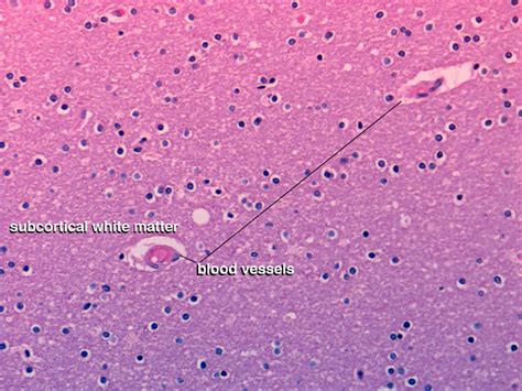 Medulla Spinalis Histology