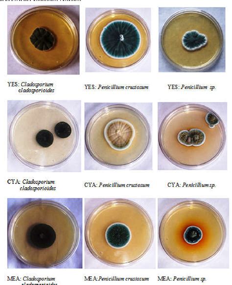 Colonial and Morphological Characteristics of various fungi Species ...