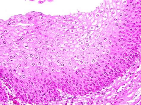 Stratified Squamous Nonkeratinized Epithelium Histology Slide Images ...