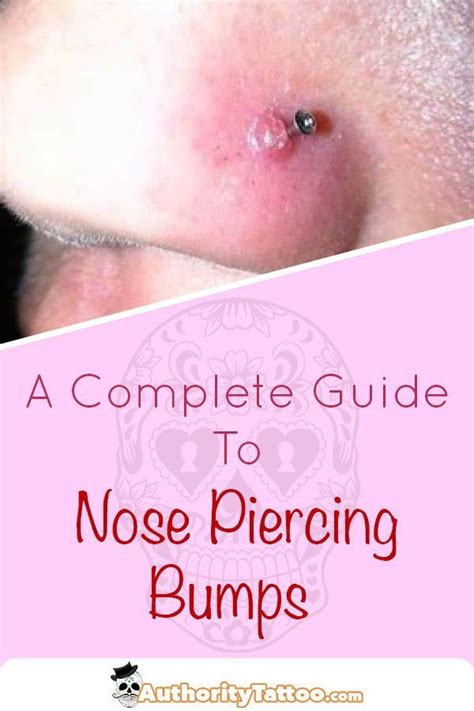 Nose piercing bumps are very common but also extremely unsightly. We ...