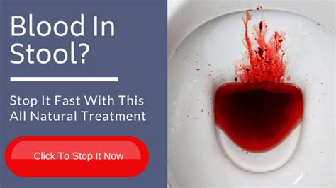 Blood in Stool? Here’s Why… - The Renegade Pharmacist