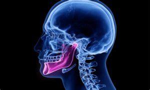 Jaw Bone Cancer: Signs, Symptoms, and Treatment Options