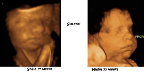 Pieces of Me: 30 week ultrasound pictures of Nadia