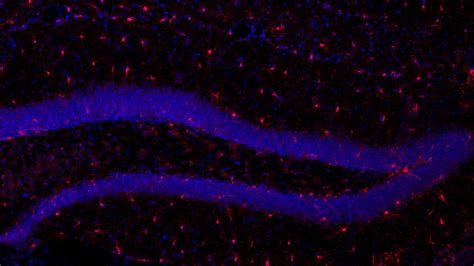 Brain cells called microglia eat away mice’s memories