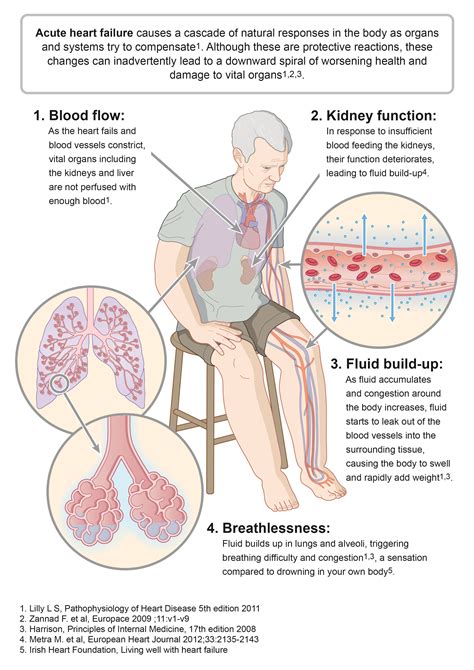 congestive heart failure symptoms - Google Search | Heart failure ...