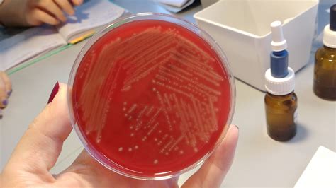 Streptococcus agalactiae/Group B streptococcus/HSB. Beta hemolytic ...