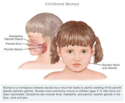 Mastoid Process : Definition, Location, Function and Pain - (updated in ...