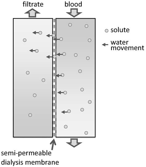 Principles and Practices of Haemodiafiltration | IntechOpen