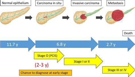 Early diagnosis of pancreatic cancer: Current trends and concerns ...