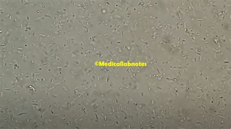 E. aerogenes: Introduction, Morphology, Pathogenicity, Lab