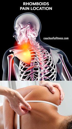 Fast Rhomboid Pain Relief With Effective Exercises & Stretches ...