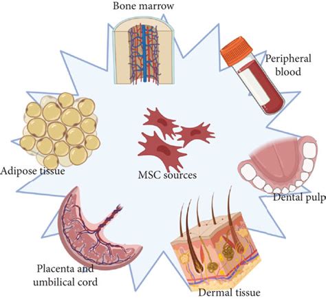 Sources of mesenchymal stem cells. Created with http://Biorender.com ...